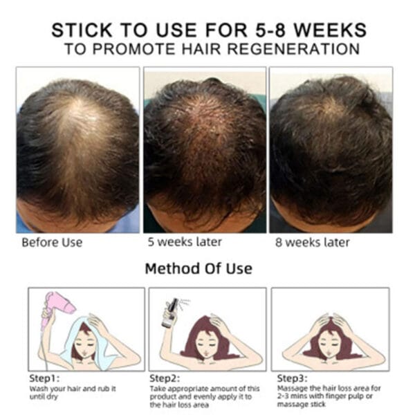 30ml Hair Growth Oil – Natural OEM Hair Care Essential Oil for Thicker, Stronger Hair - Image 2