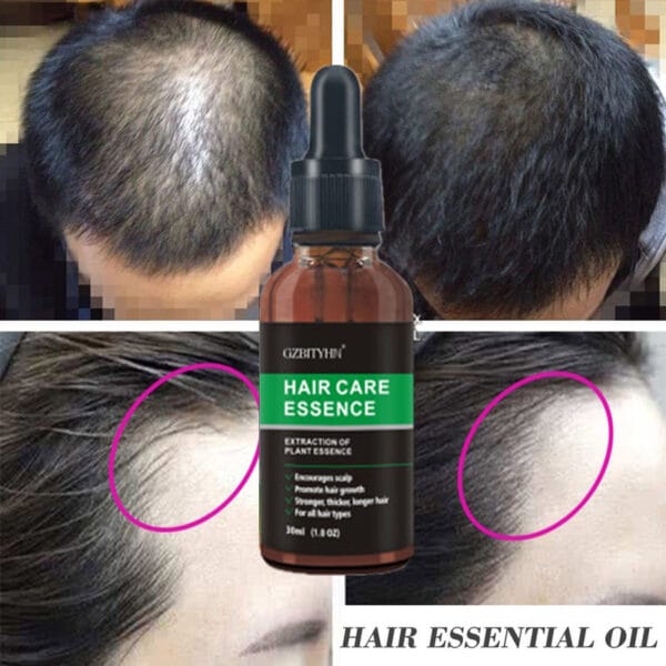 30ml Hair Growth Oil – Natural OEM Hair Care Essential Oil for Thicker, Stronger Hair - Image 6