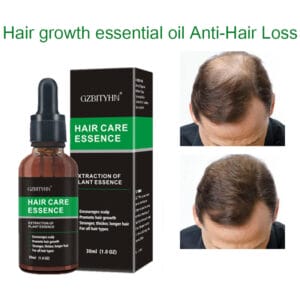 30ml Hair Growth Oil – Natural OEM Hair Care Essential Oil for Thicker, Stronger Hair