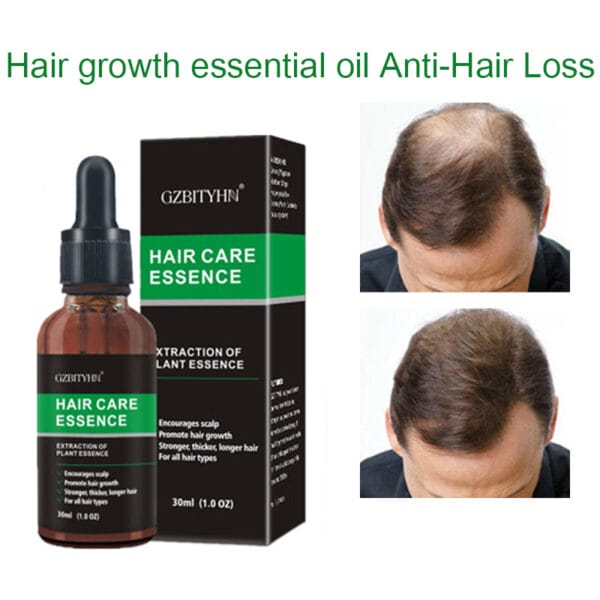 30ml Hair Growth Oil – Natural OEM Hair Care Essential Oil for Thicker, Stronger Hair