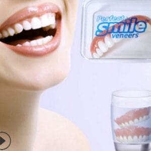 Veneers
