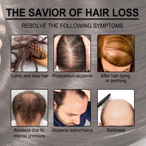 Rosemary Anti-Breakage Nourishing Hair Care Oil - Image 10