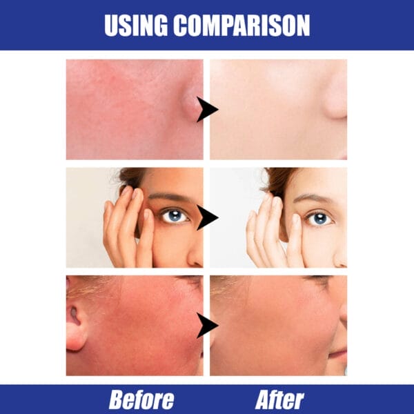 Lightweight Freshing And Moistrurizing Waterproof SPF50 Hyaluronic Acid Sun Block Stick - Image 5