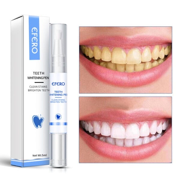 Teeth Whitening Pen Cleaning Serum Remove Plaque Stains Dental Tools Whiten Teeth Oral Hygiene Tooth Whitening Pen - Image 2