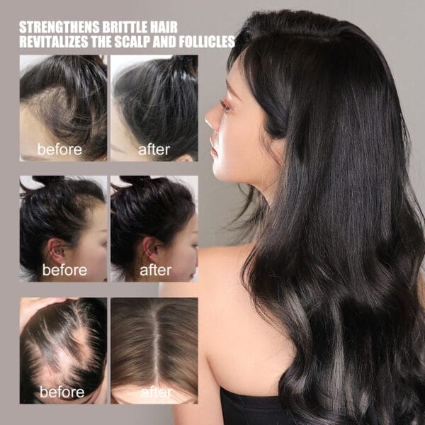 Hair Growth Repair Care Essential Oil - Image 3