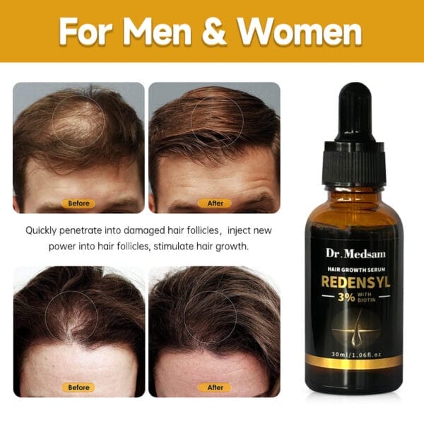 Biotin Hair Growth Rosemary Thick - Image 4