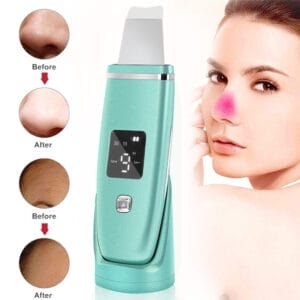 Ultrasonic Blackhead Remover & Pore Cleaner Machine for Deep Cleansing & Facial Lifting - 24000 RPM High-Frequency Skin Scrubber