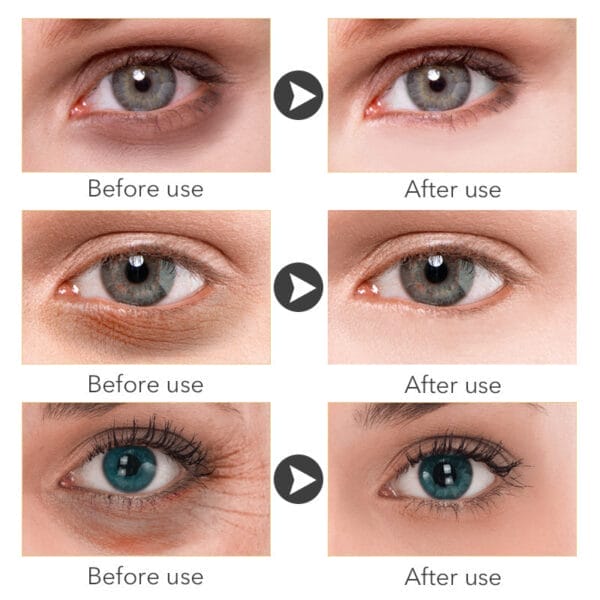 Beauty Eye Cream30mlwish Women's Skin Care Products - Image 5