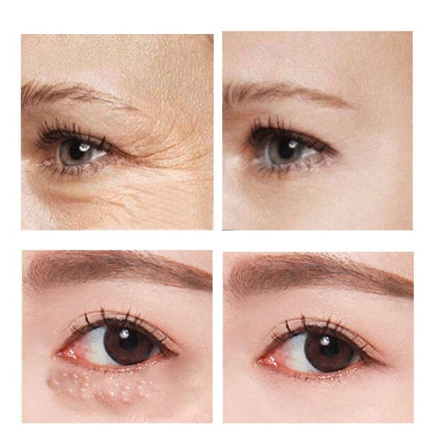 Beauty Eye Cream30mlwish Women's Skin Care Products - Image 6